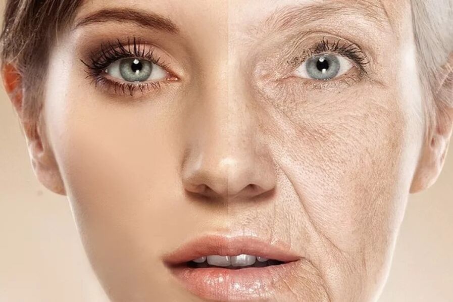 Pelle del viso dopo e prima dell'esposizione al laser ablativo frazionato